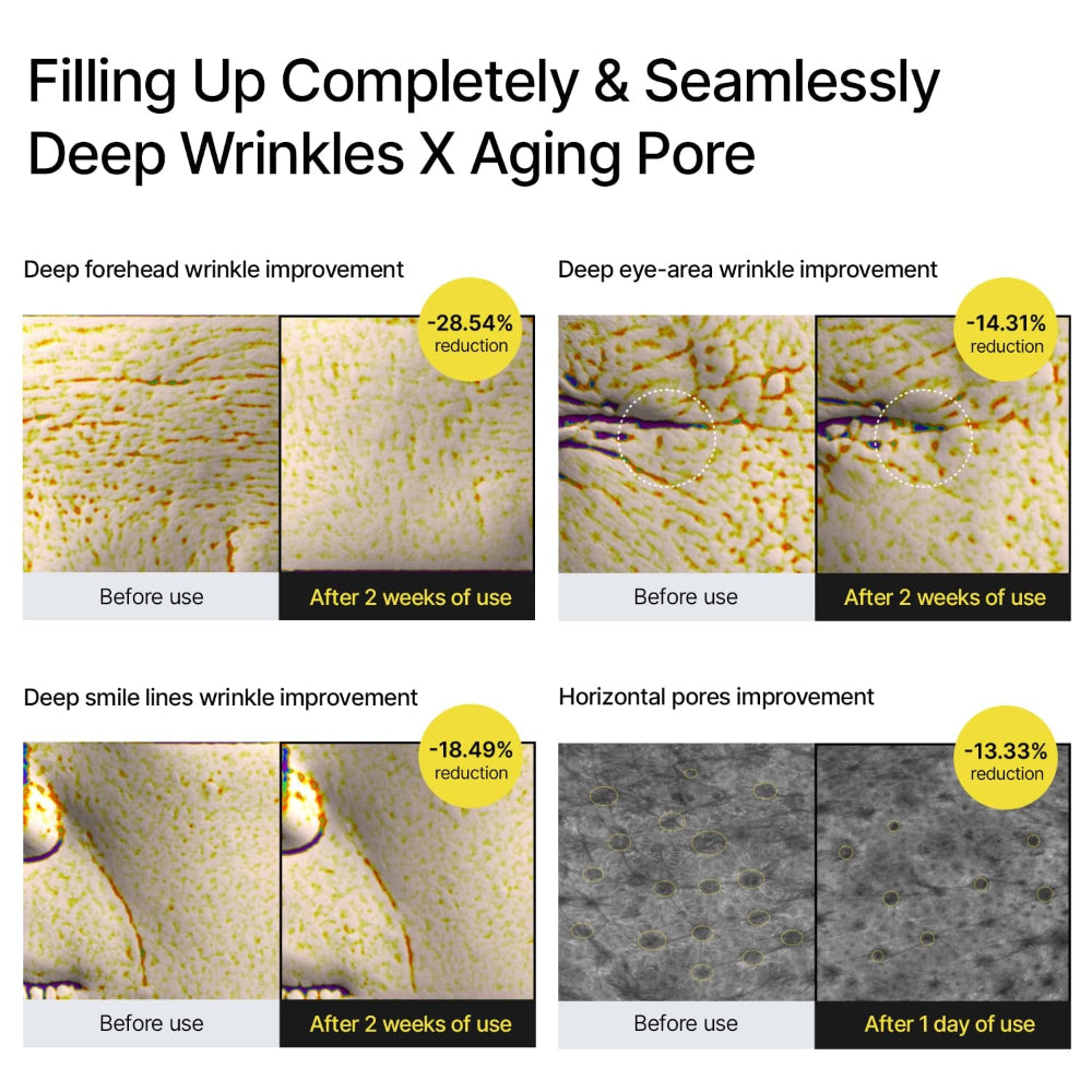 the Vita a Retinal Shot Tightening Booster | 0.1% Retinal, 3% Matryxyl, High-Strength Retinoid for Anti-Aging, Pore Minimizer, Wrinkles & Fine Lines, Firmer Skin, 15Ml, Mothers Day Gift